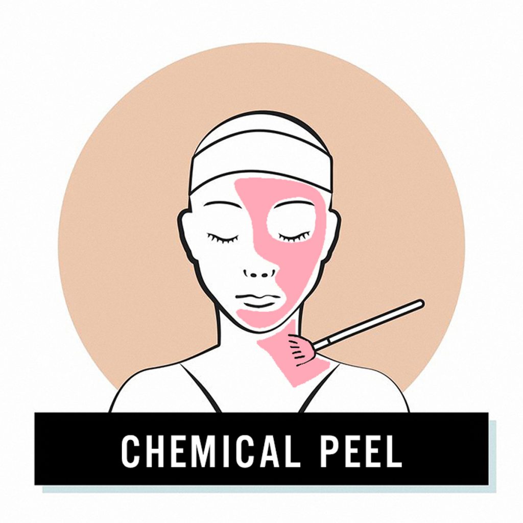 REJUVENATING PEEL